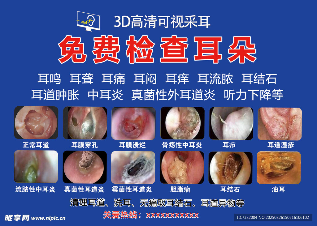 免费耳部检查示例图片