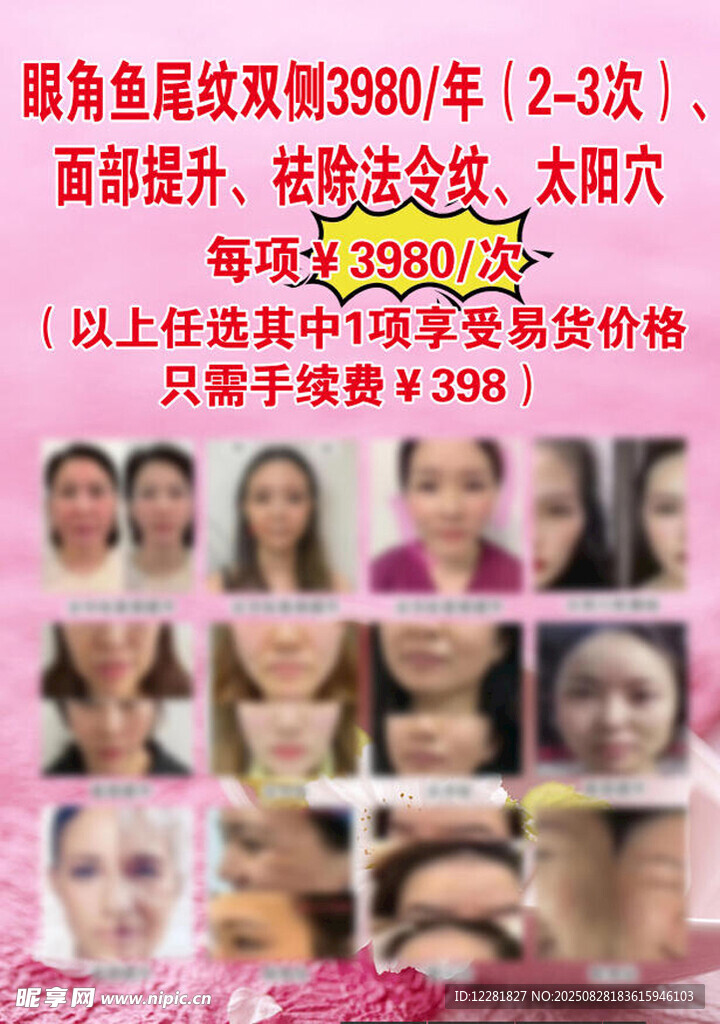 超皮秒祛斑效果对比展示
