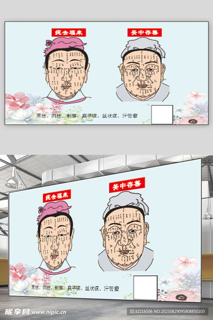 痣的位置图痣祛福来