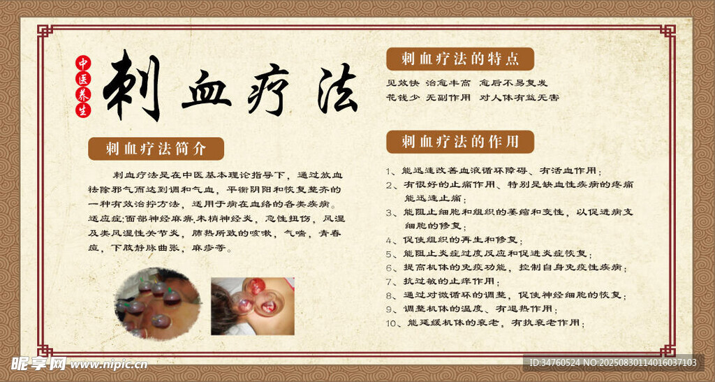 刺血疗法