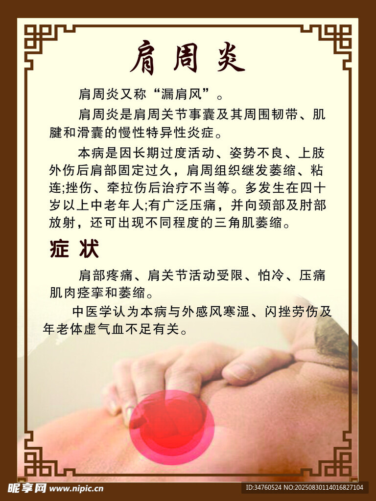 肩周炎