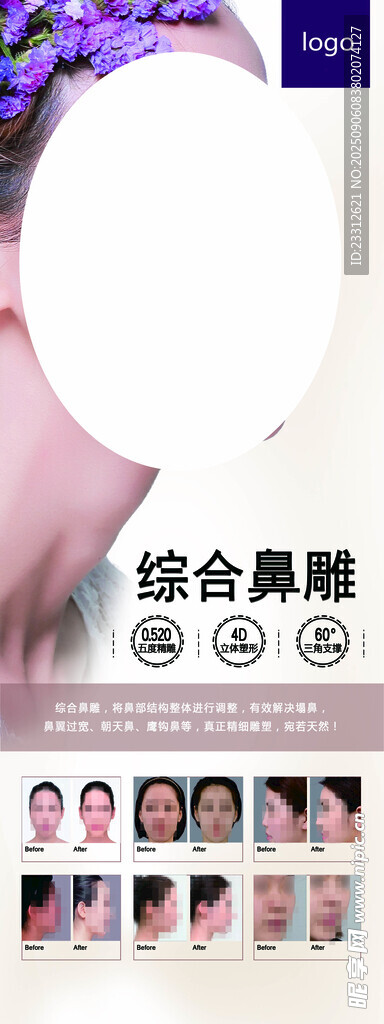 鼻综合