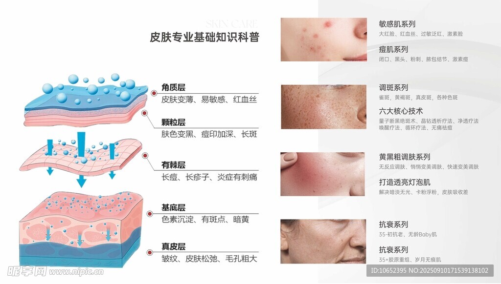 皮肤结构与问题图示展版