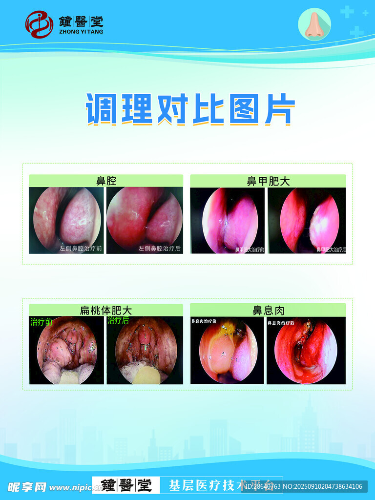 肝脏病理调理对比图片