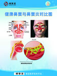 健康鼻窦与鼻窦炎症对比图
