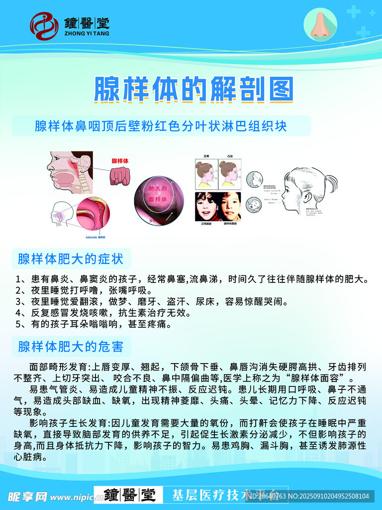 腺样体切除术图解