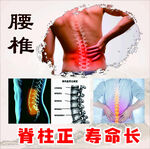 腰椎健康与脊柱形态展示