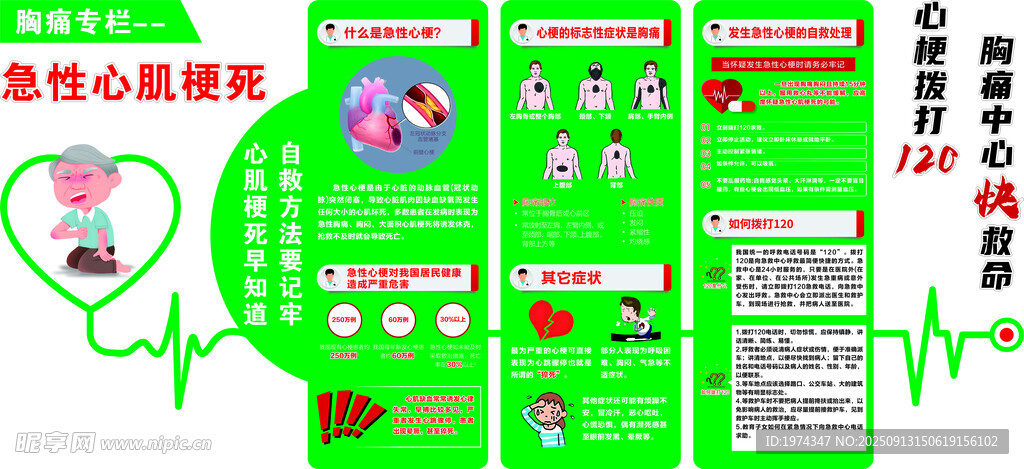 急性心肌梗死