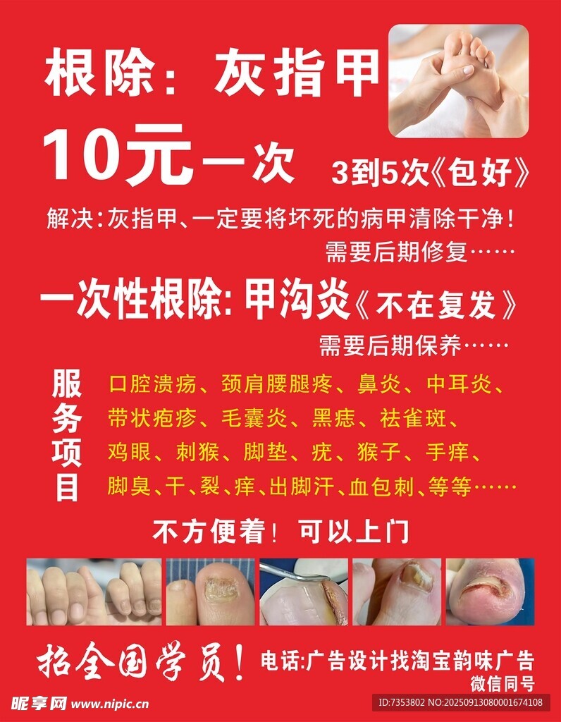 灰指甲