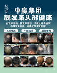 脱发头部健康展示