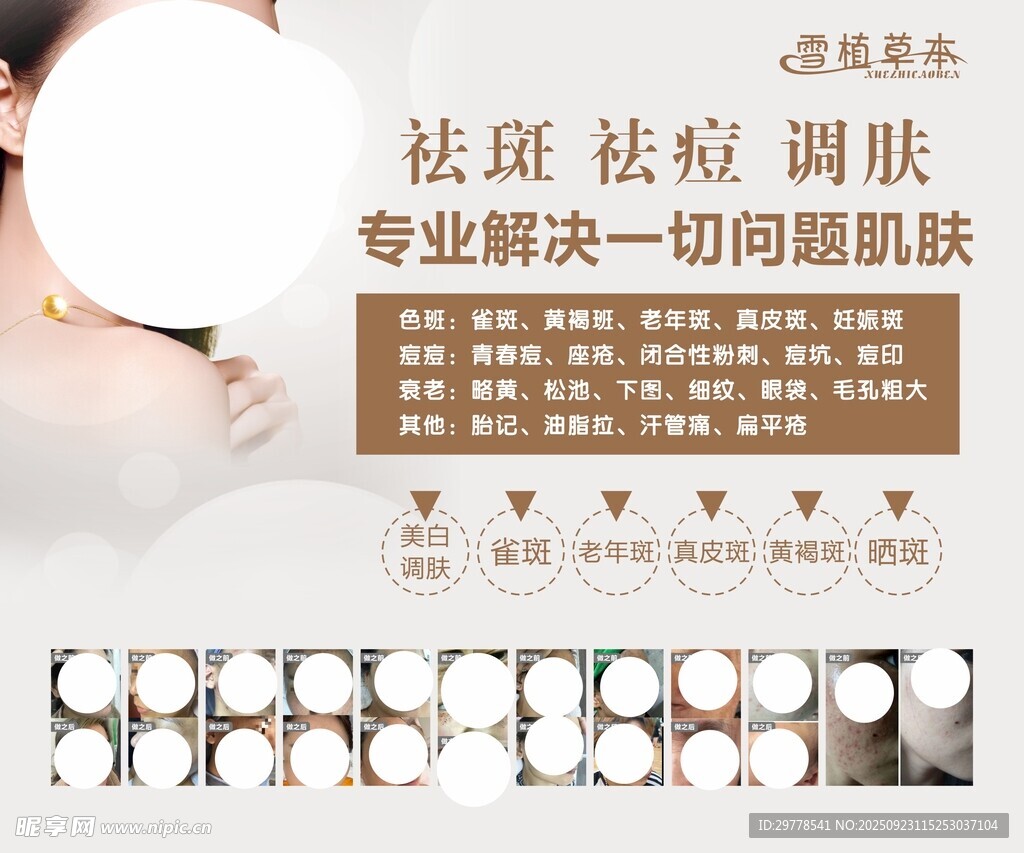 祛斑祛痘专业肌肤解决方案