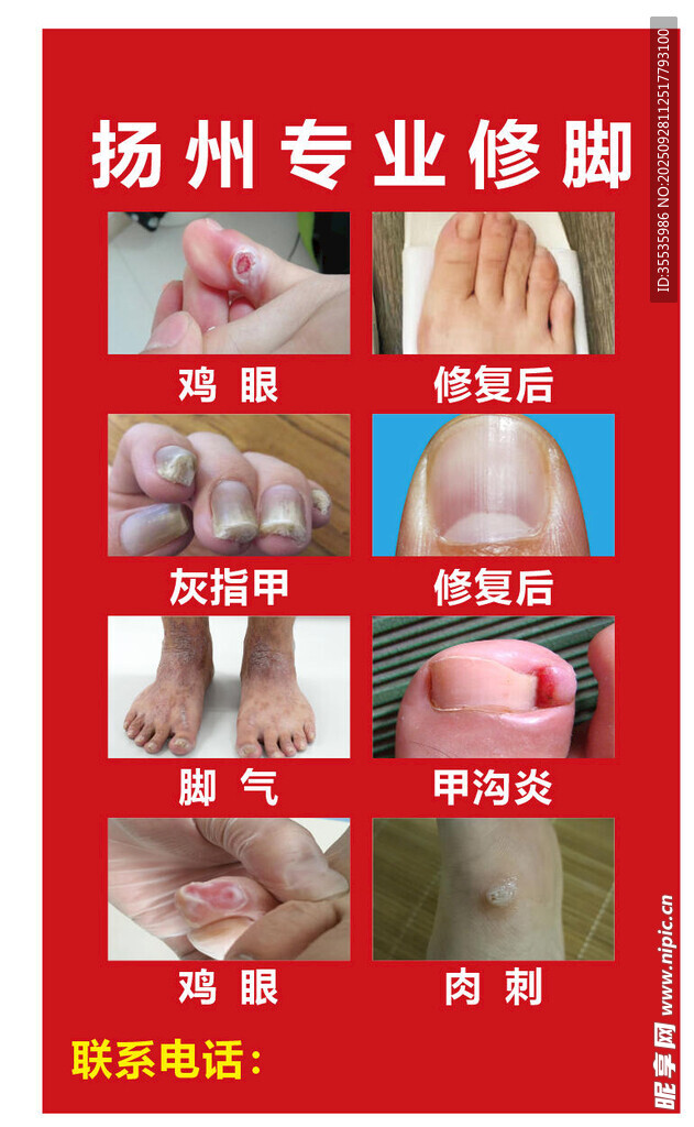 扬州专修脚