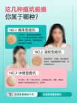 揭秘不同症状的痘痘类型