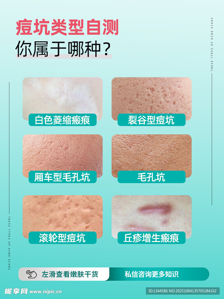 这几种痘坑瘢痕海报设计