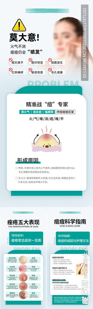 痘痘痤疮海报
