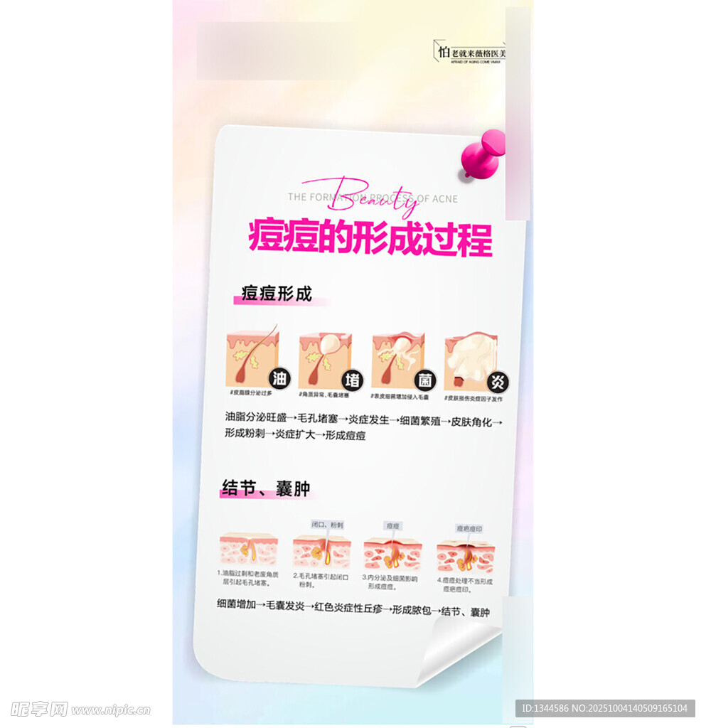 青春痘科普海报