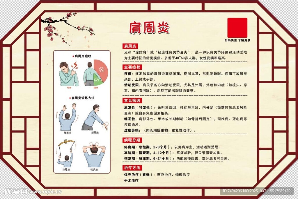 肩周炎