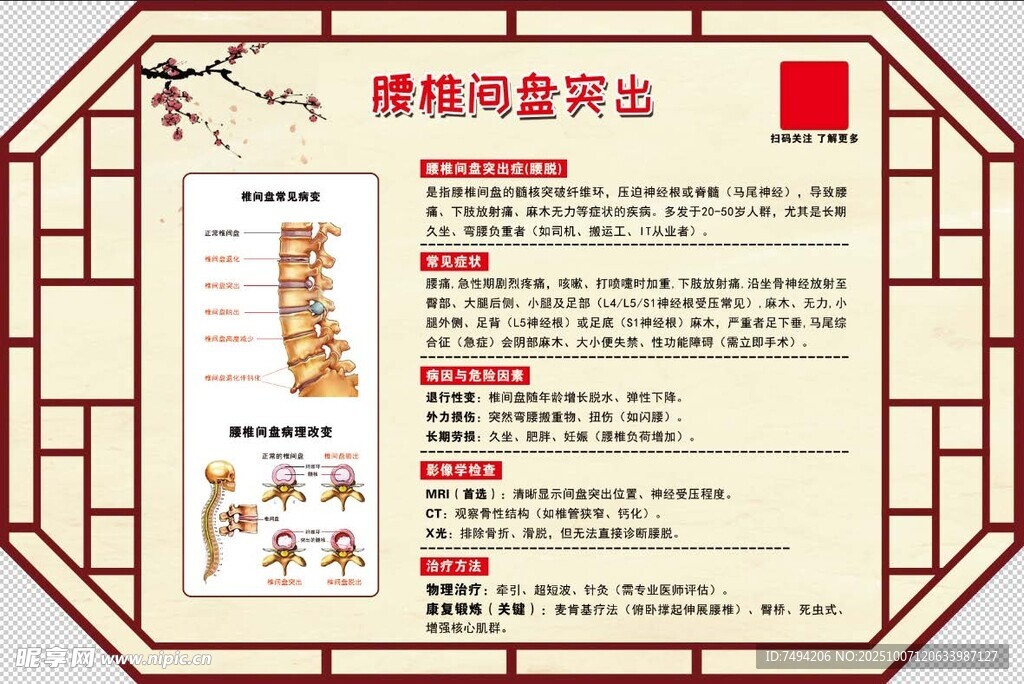 腰椎间盘突出