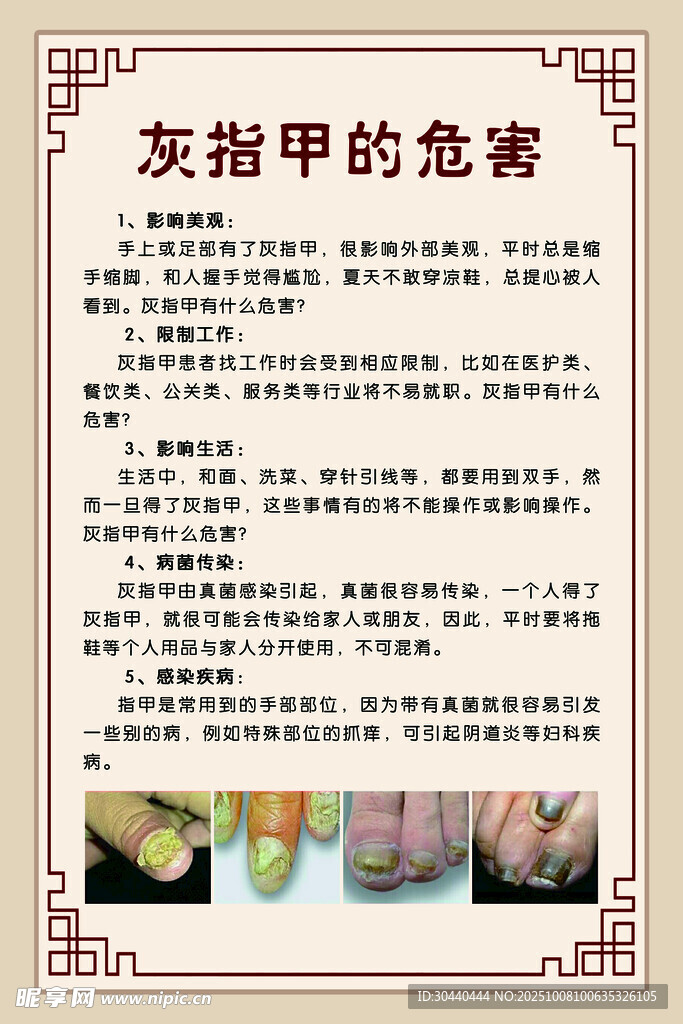 灰指甲的危害介绍