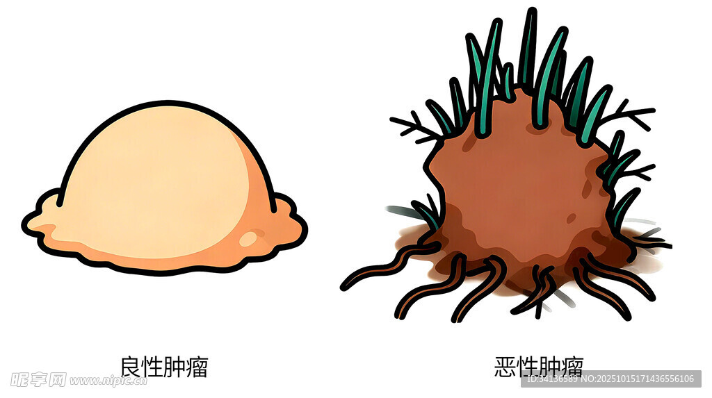 良性肿瘤与恶性肿瘤卡通对比图
