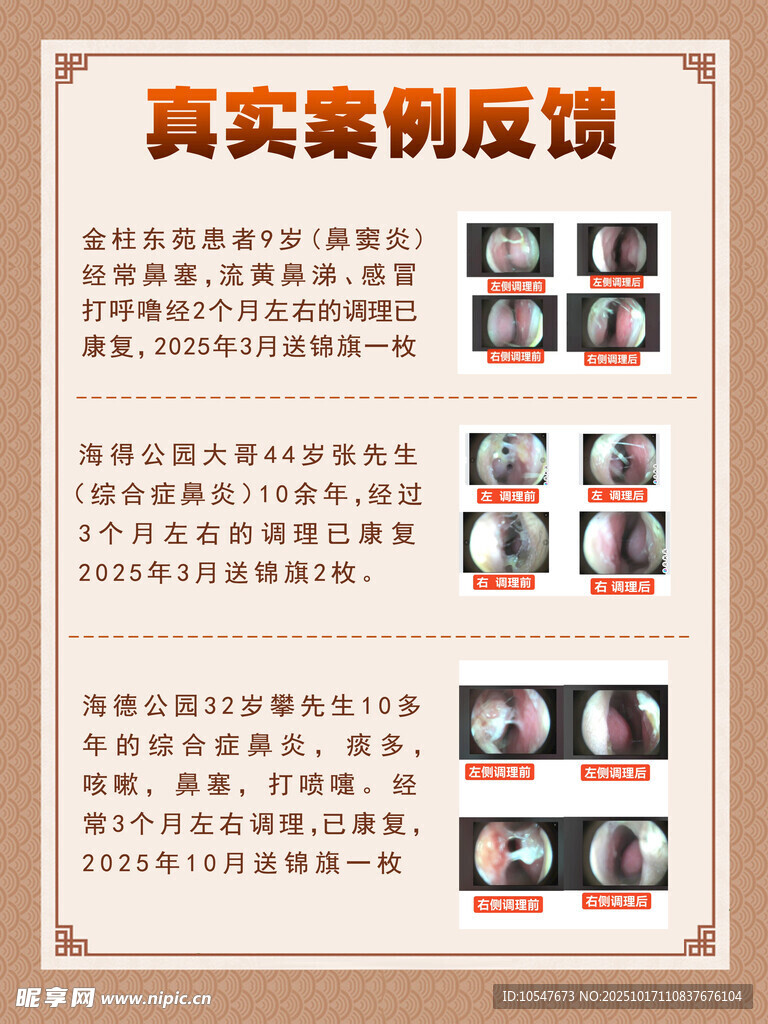 鼻炎海报