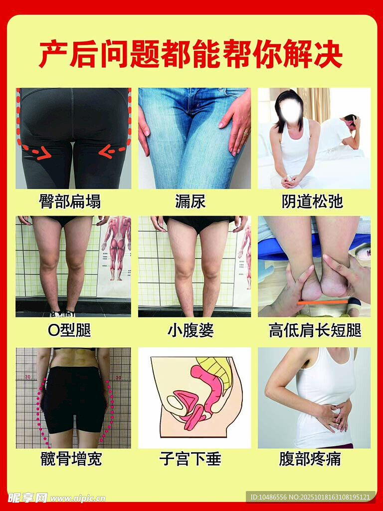 产后私密保养