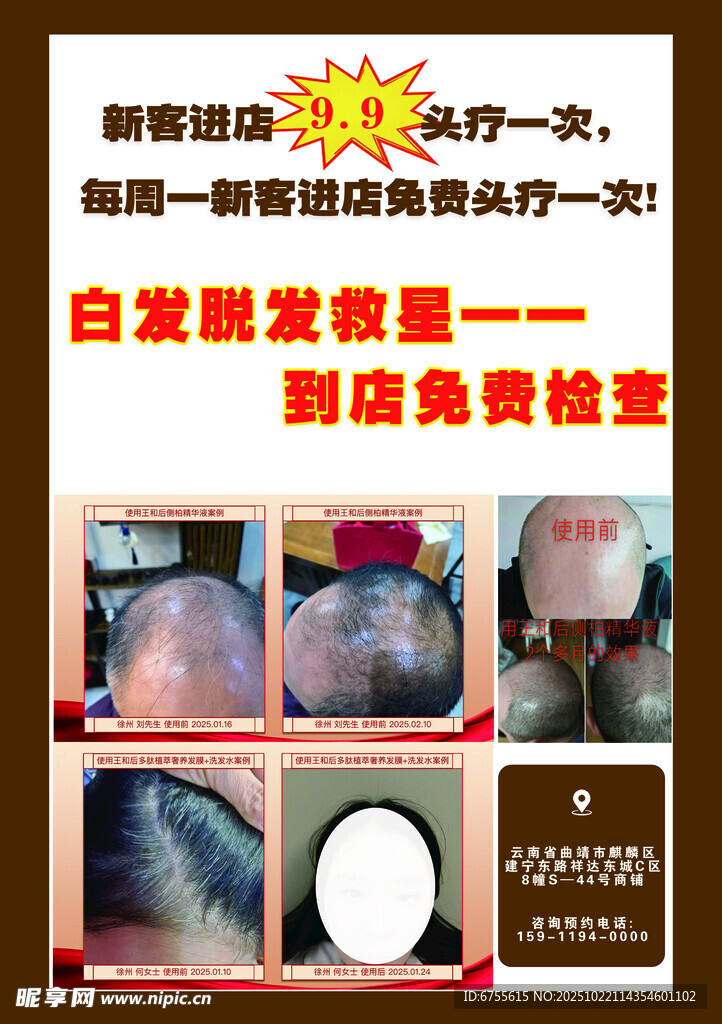 白发脱发免费检测活动