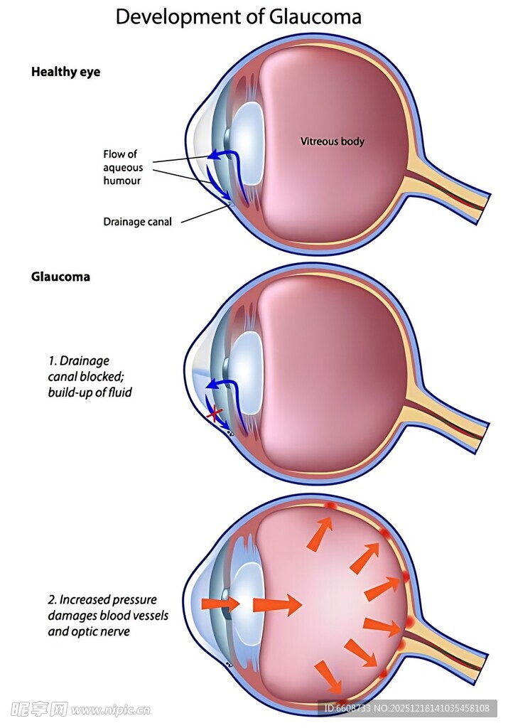 眼睛发育各阶段示意图