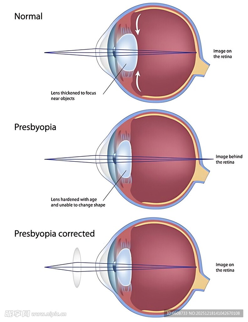 眼睛不同生理状态示意图