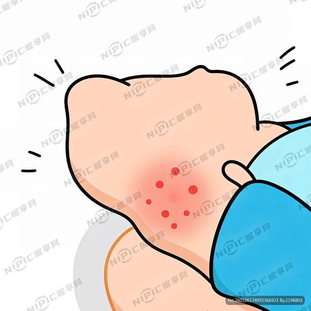 婴幼儿下巴周围有湿疹