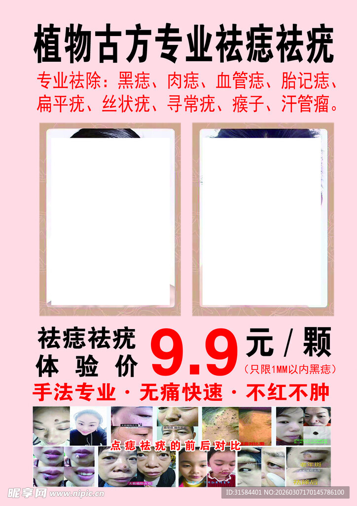 植物古方专业祛痘
