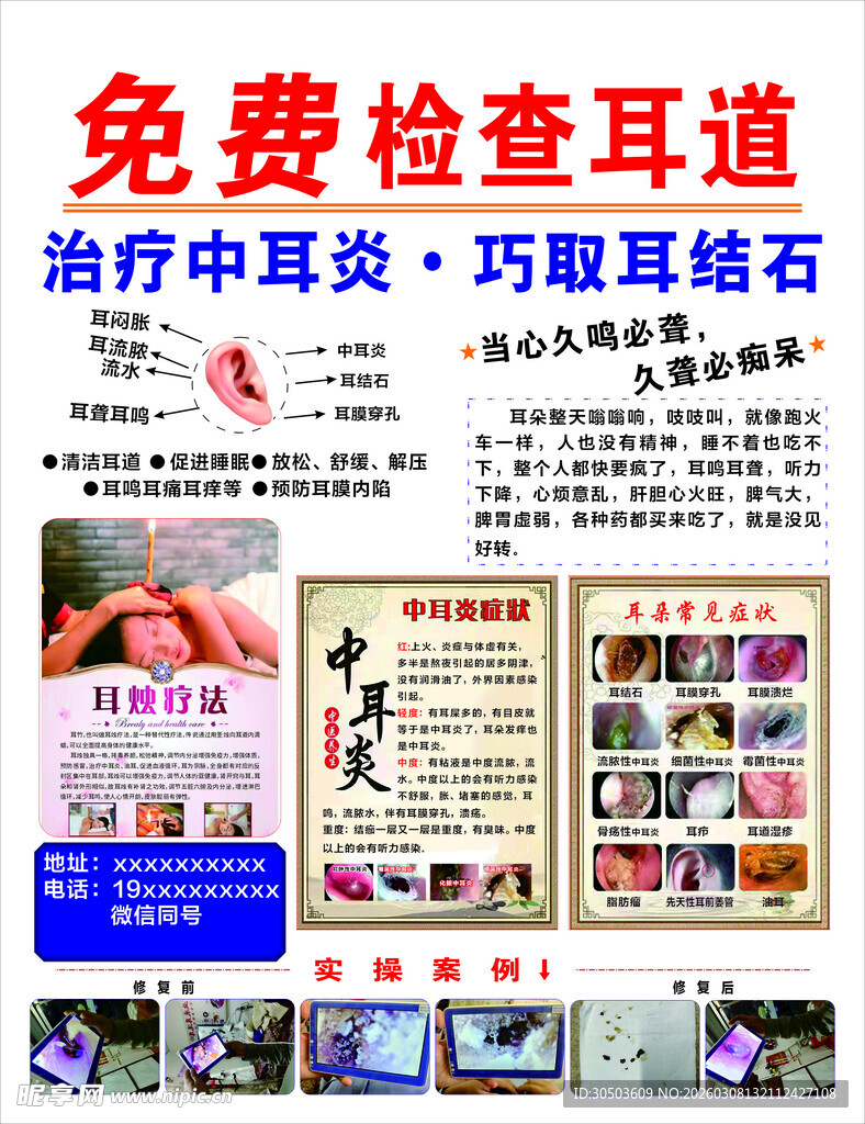 耳道检查 免费