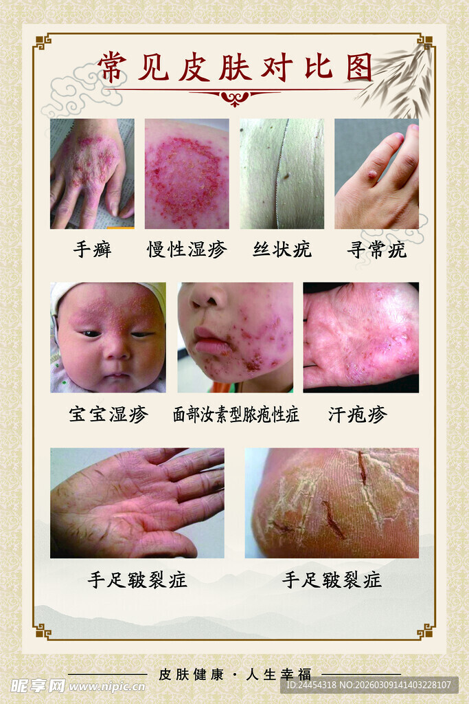 常见皮肤病对比图示