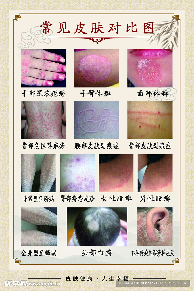 常见皮肤对比图示
