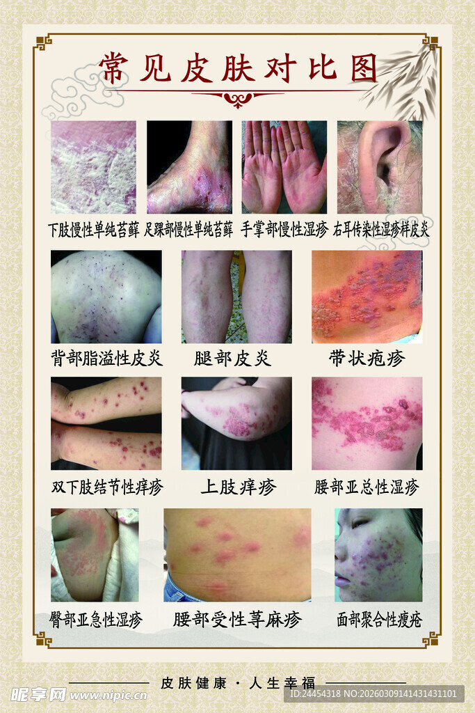 常见皮肤对比图鉴