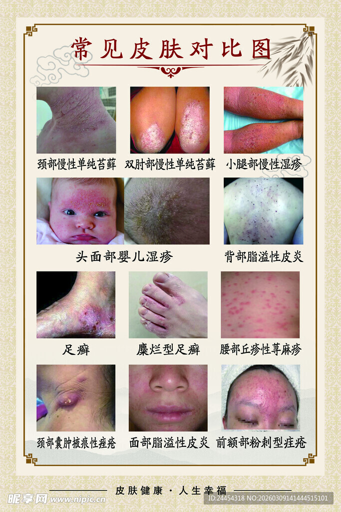 常见皮肤病对比图示