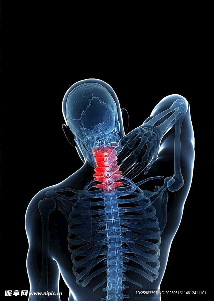 颈部疼痛示意图