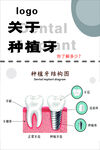 种植牙科普图示