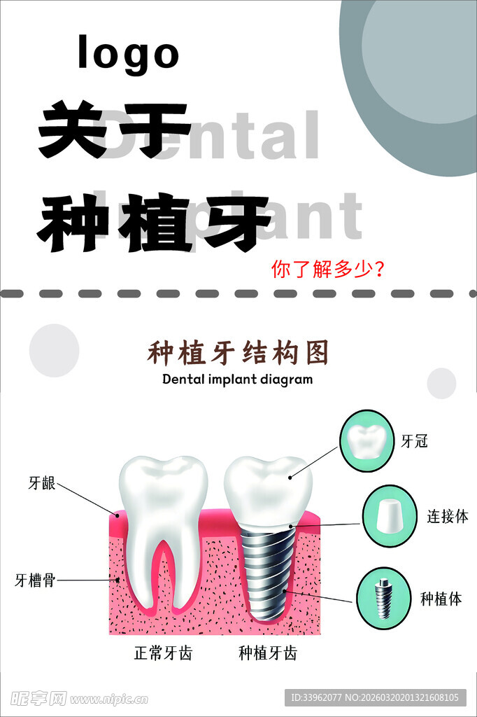 种植牙科普图示