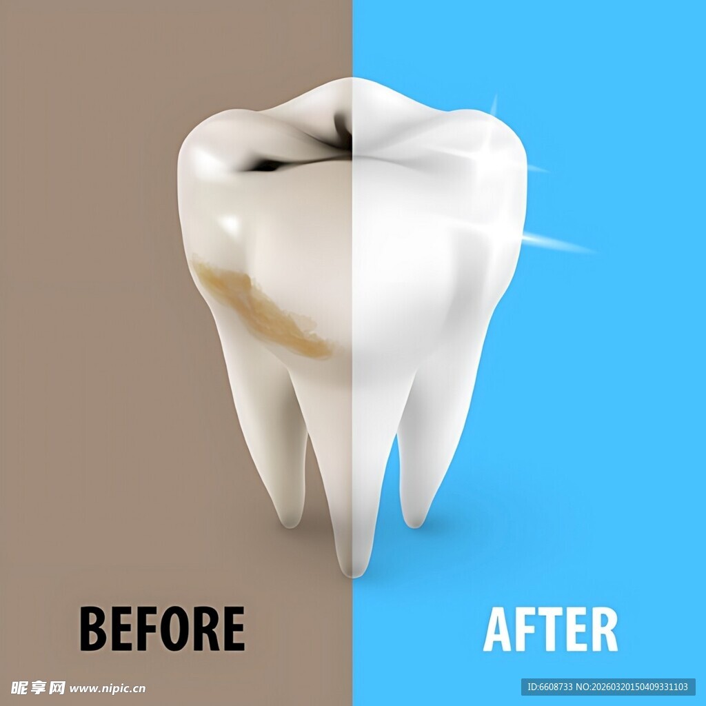 白色种植牙模型展示