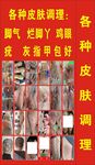 各类皮肤问题调理海报