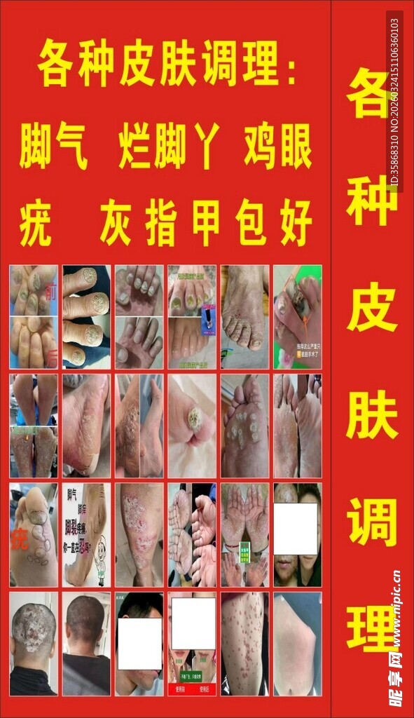 各类皮肤问题调理海报