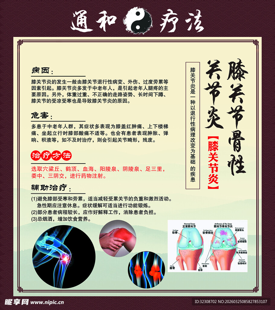 膝关节骨性关节炎