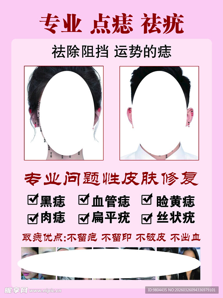专业点痣祛斑服务海报