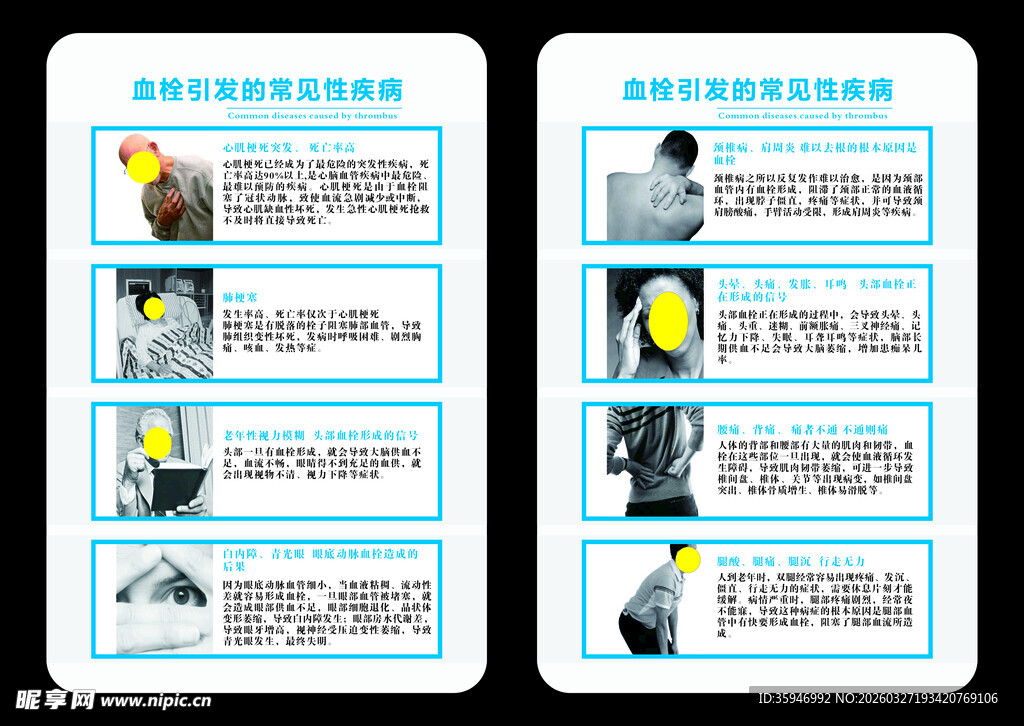 血栓引发的常见性疾病