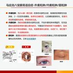 马应龙八宝眼膏