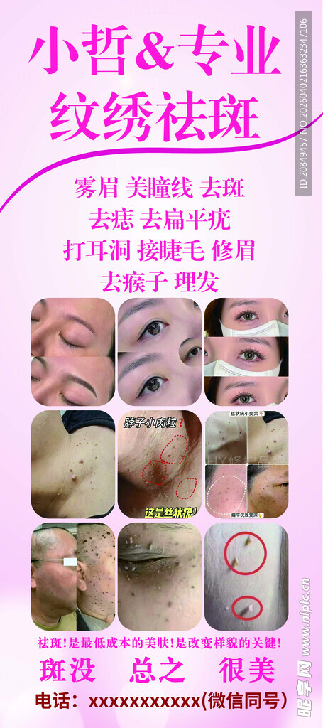 专业纹绣祛斑展示
