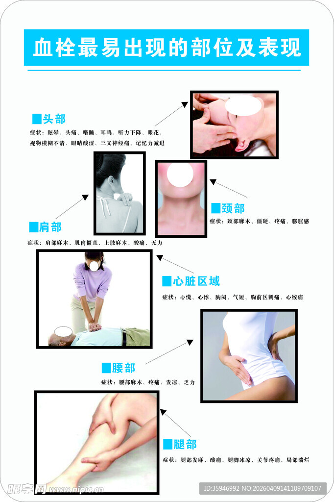 血栓容易出现的部位及表现