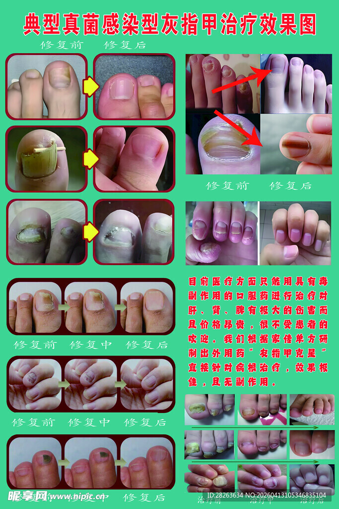 美甲贴钻制作步骤展示