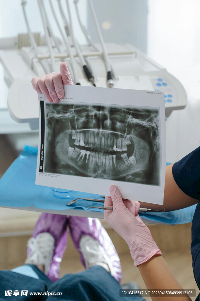 医生手持牙科X光片